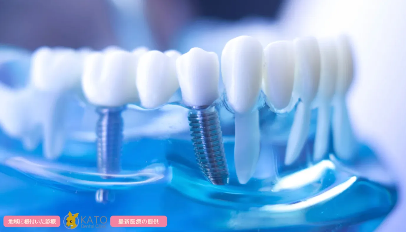 インプラントは違和感が少ない?入れ歯との違いと快適に噛める理由を解説