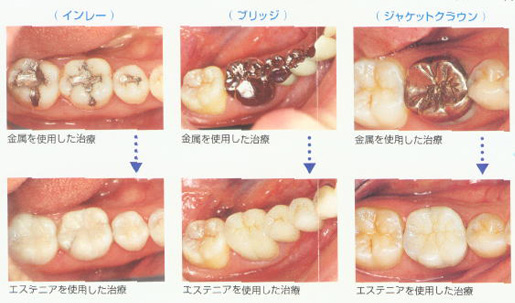 エステニアとは
